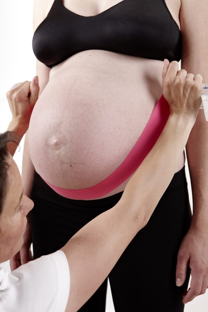 Support during pregnancy with tape